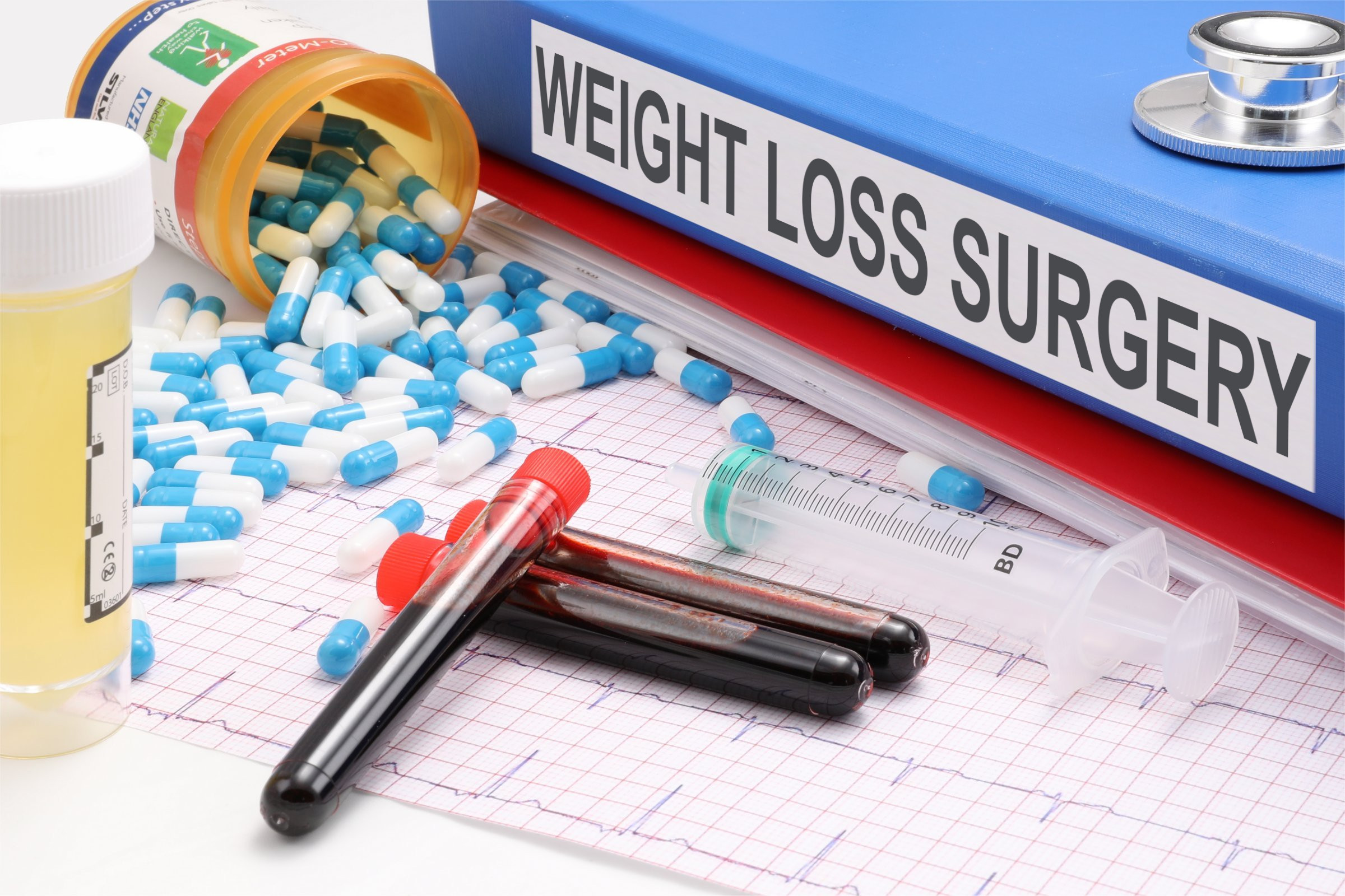 Understanding the Cost of Weight Loss Surgery