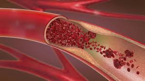 Vascular Problems and Their Impact on Overall Health